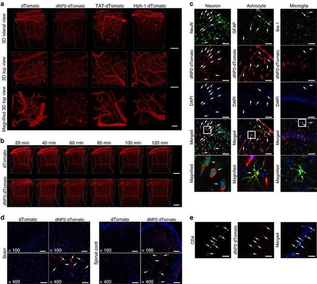 CD4 Antibody in Immunohistochemistry (IHC)