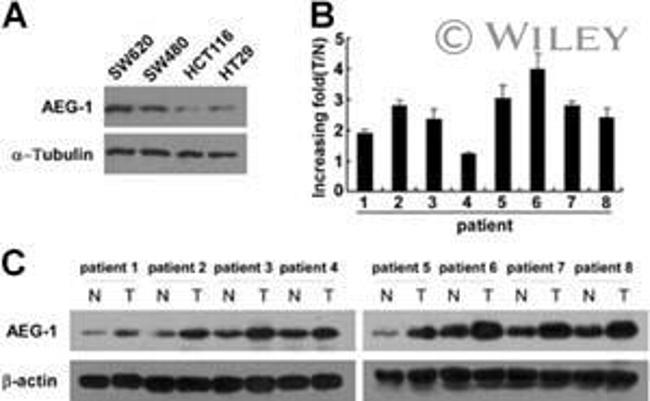 Metadherin Antibody in Western Blot (WB)