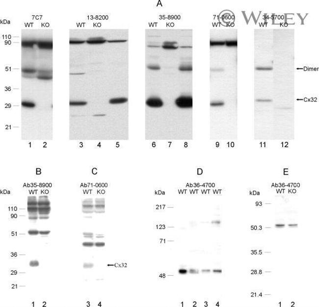 Connexin 32 Antibody in Western Blot (WB)