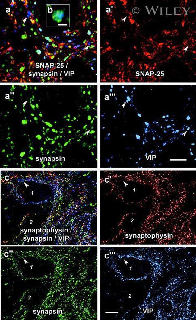 SNAP25 Antibody in Immunohistochemistry (IHC)