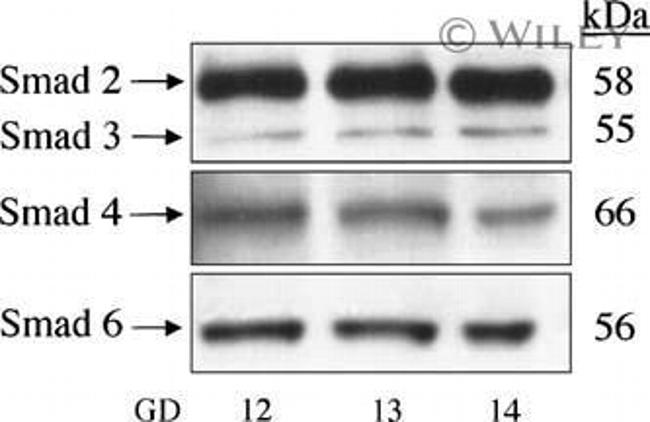 SMAD3 Antibody in Western Blot (WB)