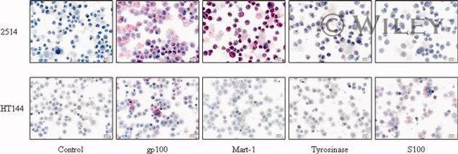 Tyrosinase Antibody in Immunohistochemistry (IHC)