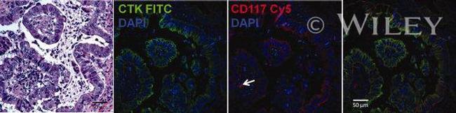 Pan Cytokeratin Antibody in Immunohistochemistry (IHC)