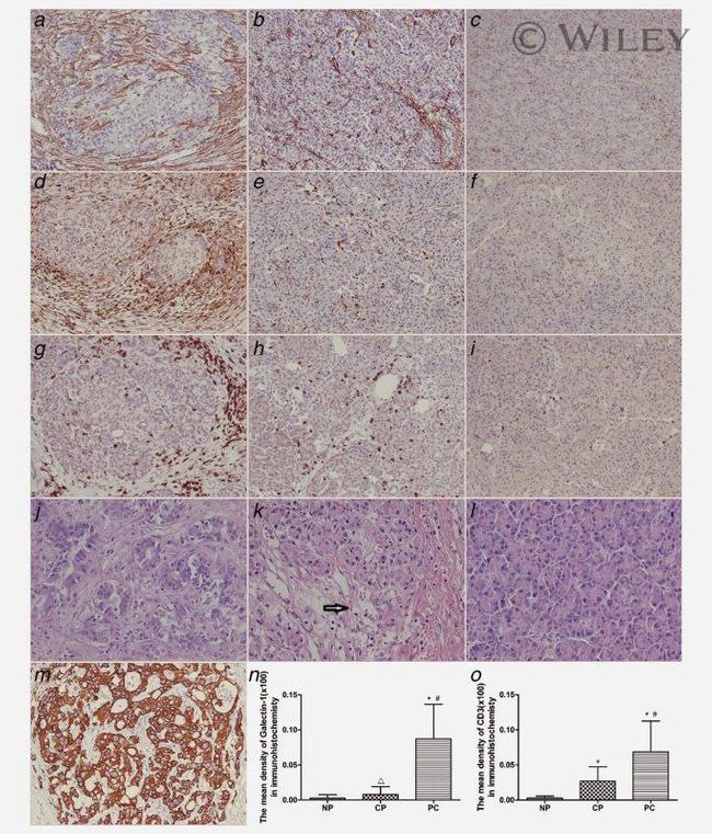 Cytokeratin 19 Antibody in Immunohistochemistry (IHC)