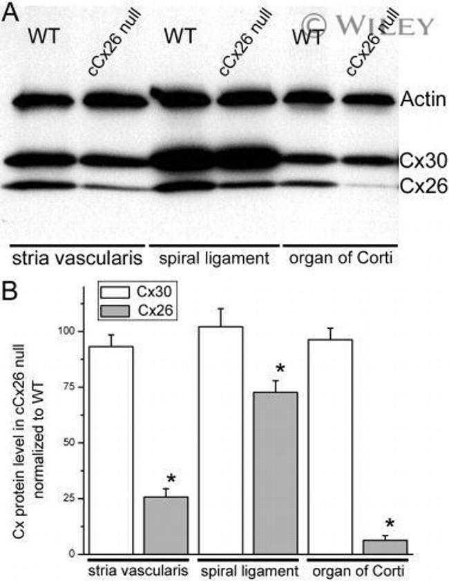 Connexin 26 Antibody in Western Blot (WB)