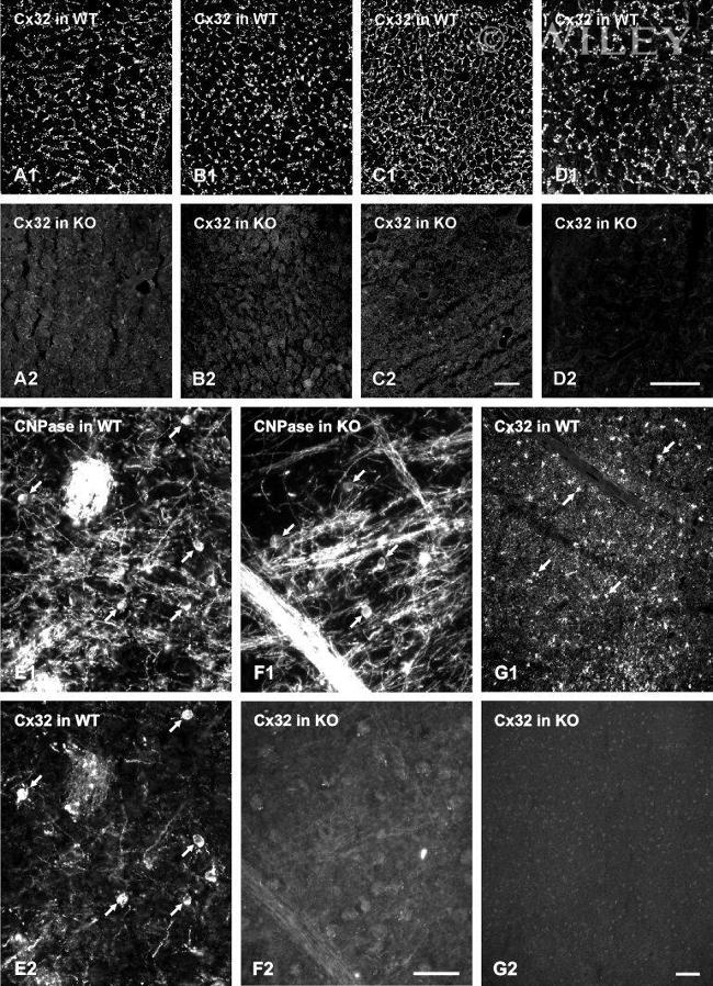 Connexin 32 Antibody in Immunohistochemistry (IHC)