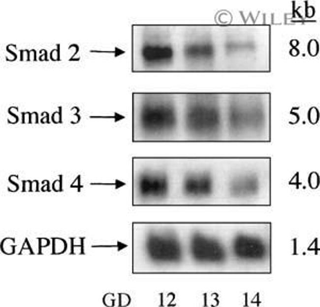 SMAD3 Antibody in Western Blot (WB)