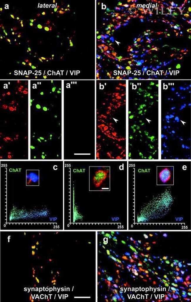 SNAP25 Antibody in Immunohistochemistry (IHC)