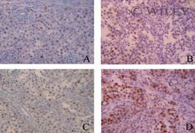 Aurora B Antibody in Immunohistochemistry (IHC)