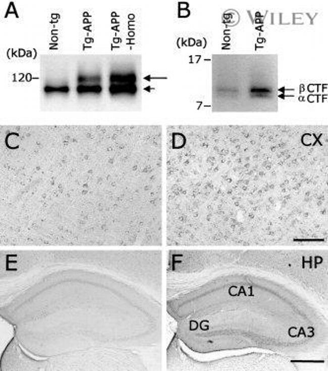 Amyloid Precursor Protein Antibody in Western Blot, Immunohistochemistry (WB, IHC)