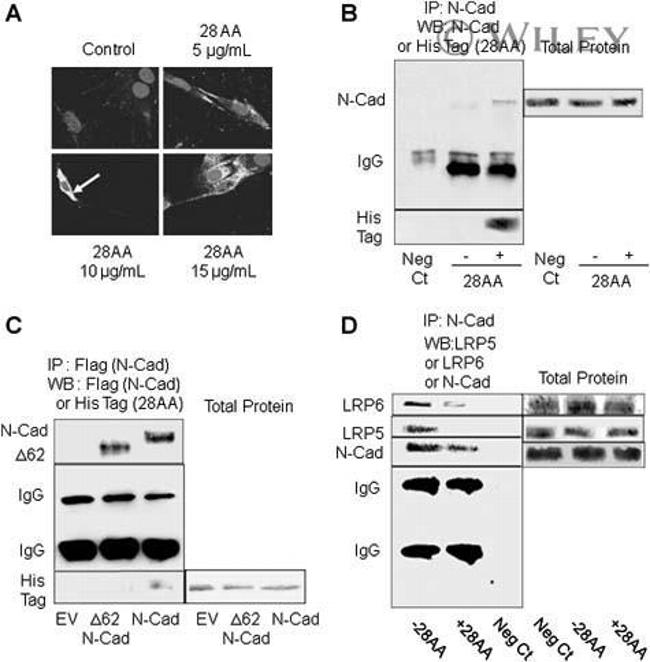 LRP5 Antibody in Western Blot (WB)