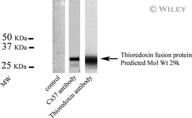 GJA10 Antibody in Western Blot (WB)