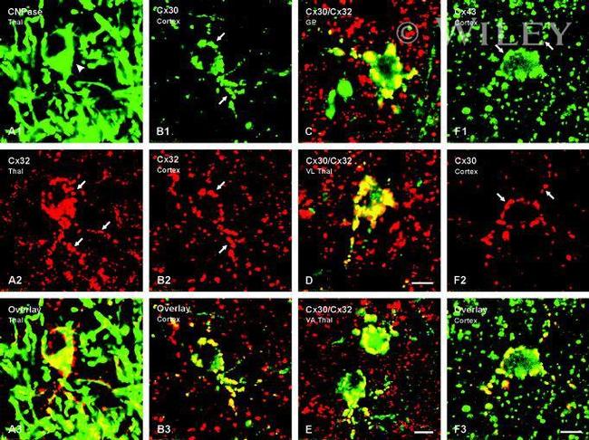 Connexin 32 Antibody in Immunohistochemistry (IHC)