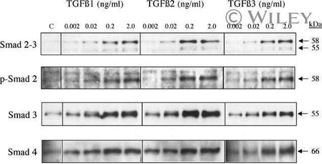 SMAD3 Antibody in Western Blot (WB)