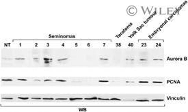 Aurora B Antibody in Western Blot (WB)