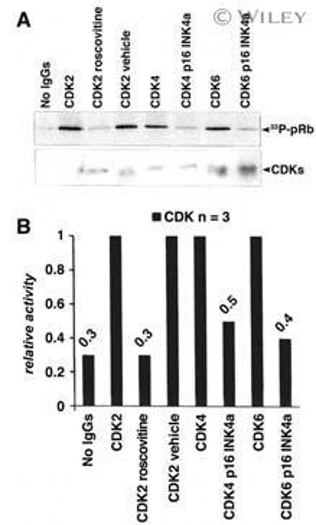 Phospho-Rb (Thr821) Antibody in Western Blot (WB)