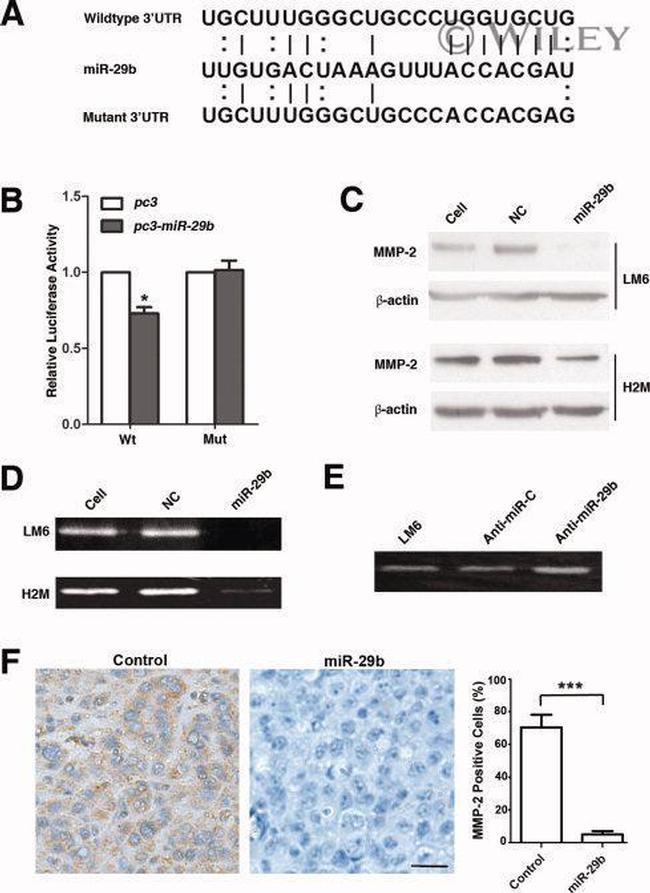 MMP2 Antibody in Immunohistochemistry (Paraffin) (IHC (P))