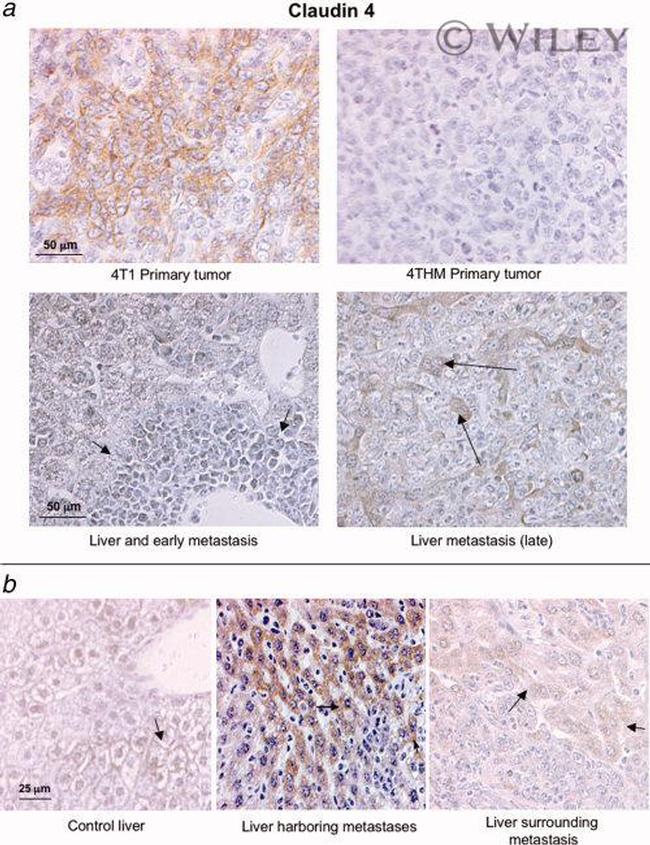 Claudin 4 Antibody in Immunohistochemistry (IHC)