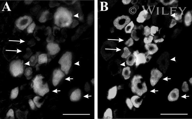 NMDAR2B Antibody in Immunohistochemistry (IHC)