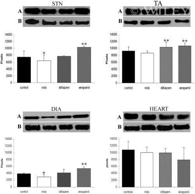 Calsequestrin Antibody in Western Blot (WB)