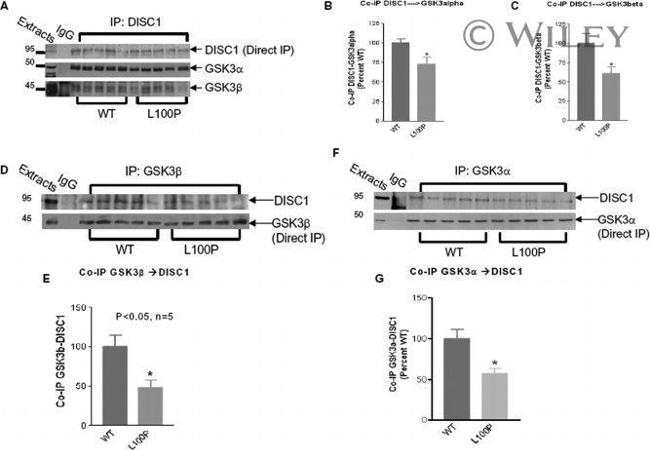 DISC1 Antibody in Immunoprecipitation (IP)