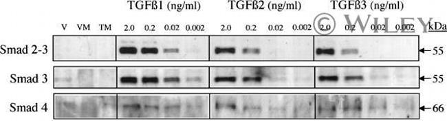 SMAD3 Antibody in Western Blot (WB)