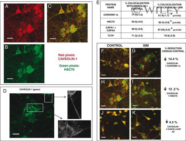 Coronin 1A Antibody in Immunocytochemistry (ICC/IF)