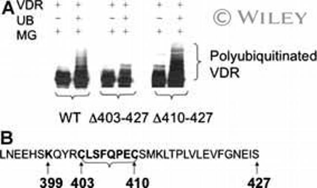 VDR Antibody in Western Blot (WB)