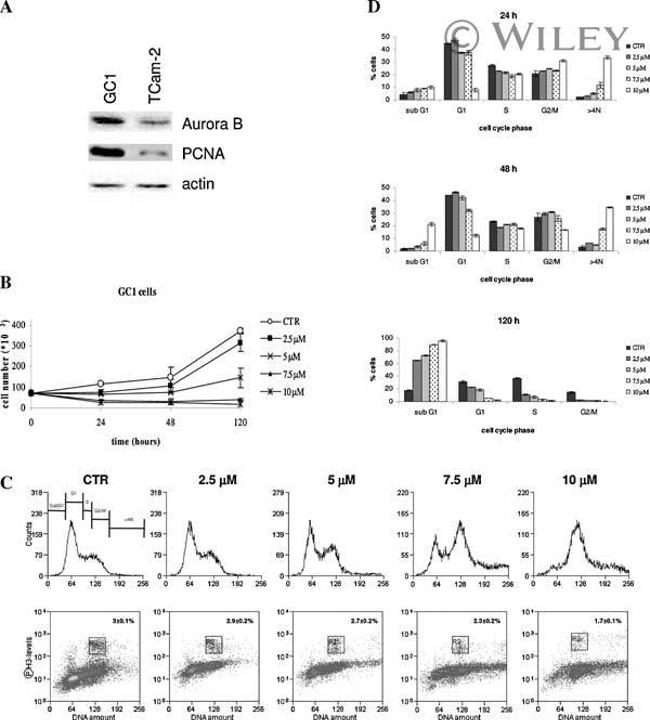 Aurora B Antibody in Western Blot (WB)