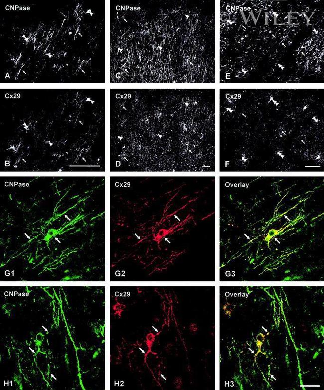 Connexin 29 Antibody in Immunohistochemistry (Frozen) (IHC (F))