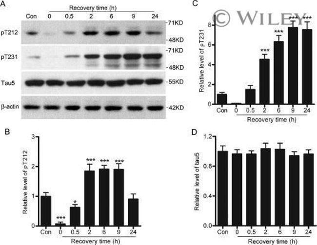 Phospho-Tau (Thr212) Antibody in Western Blot (WB)