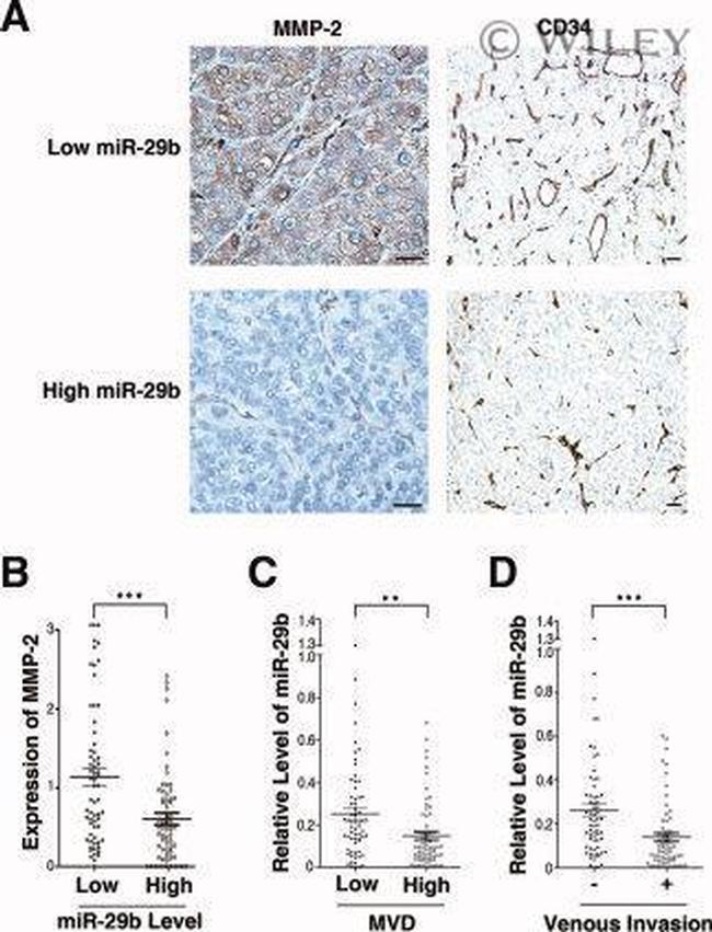 MMP2 Antibody in Immunohistochemistry (Paraffin) (IHC (P))