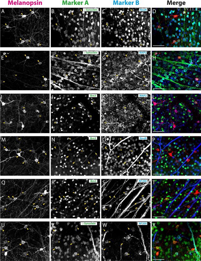 Opsin 4 Antibody in Immunocytochemistry (ICC/IF)