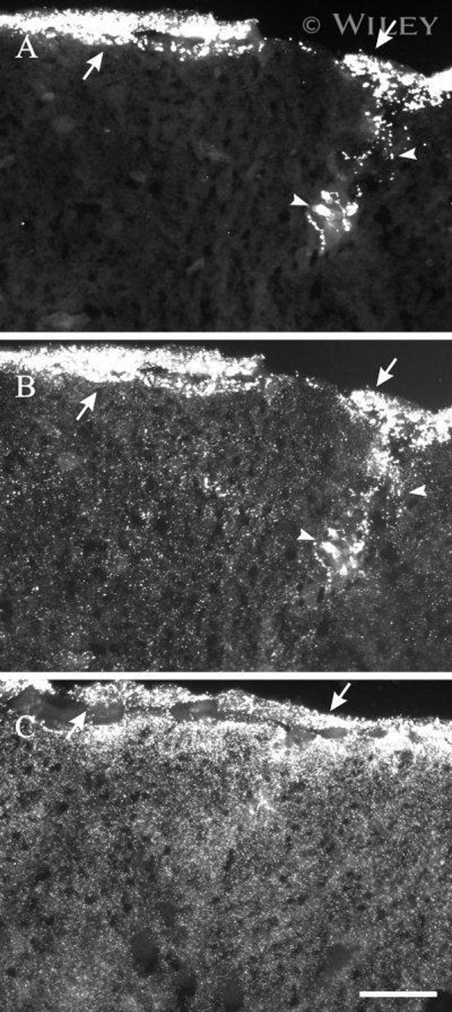 Connexin 26 Antibody in Immunohistochemistry (IHC)