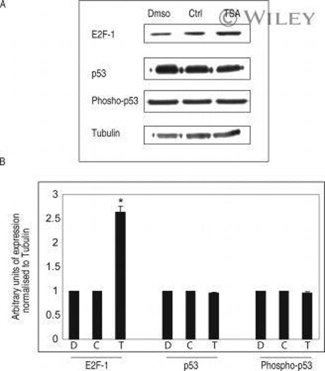 E2F1 Antibody in Western Blot (WB)