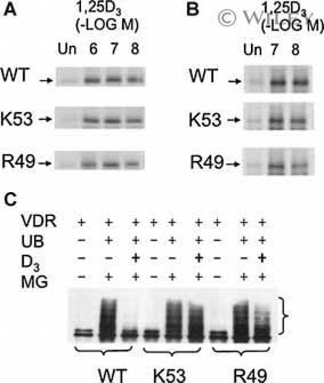 VDR Antibody in Western Blot (WB)