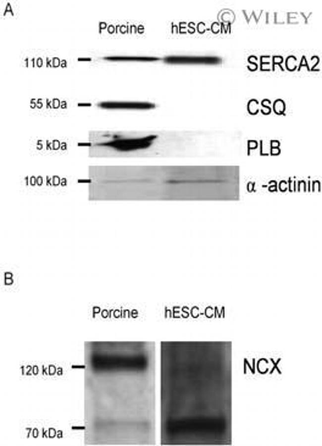 Sodium/Calcium Exchanger Antibody in Western Blot (WB)