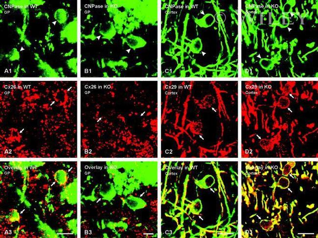 Connexin 29 Antibody in Immunohistochemistry (IHC)