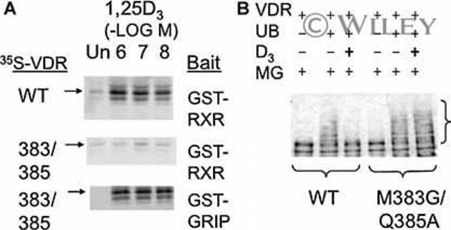 VDR Antibody in Western Blot (WB)