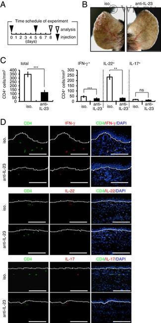 IL-23 p19 Antibody in Neutralization (Neu)