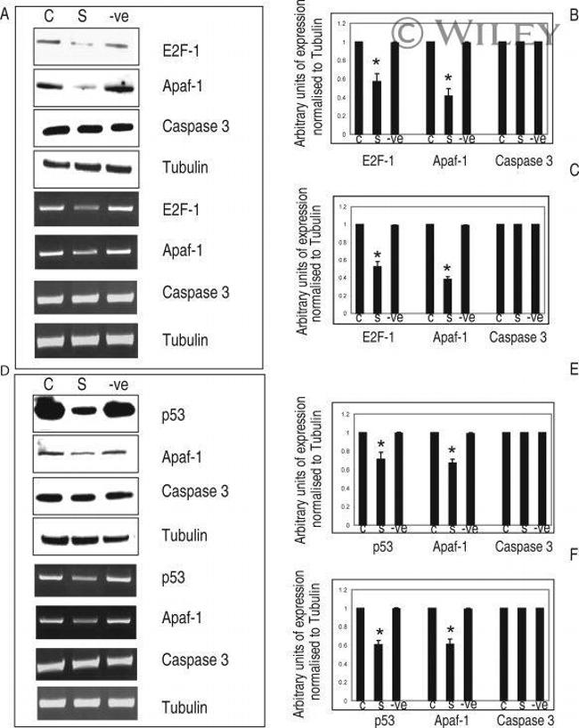 E2F1 Antibody in Western Blot (WB)