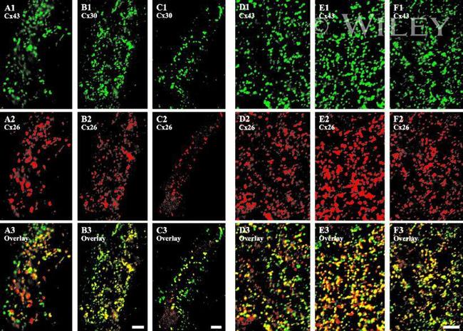 Connexin 26 Antibody in Immunohistochemistry (IHC)