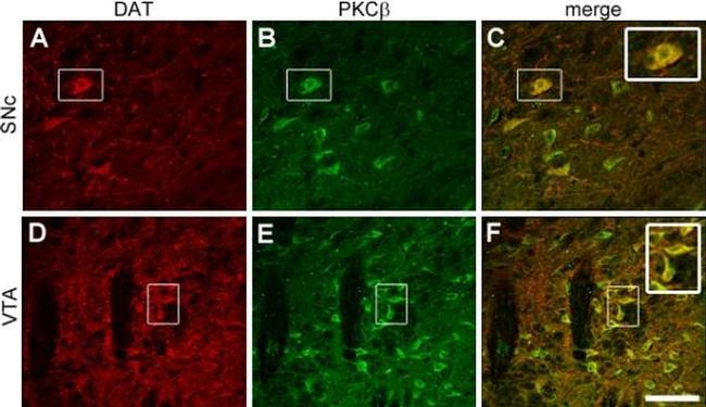 PKC beta-2 Antibody in Immunocytochemistry (ICC/IF)