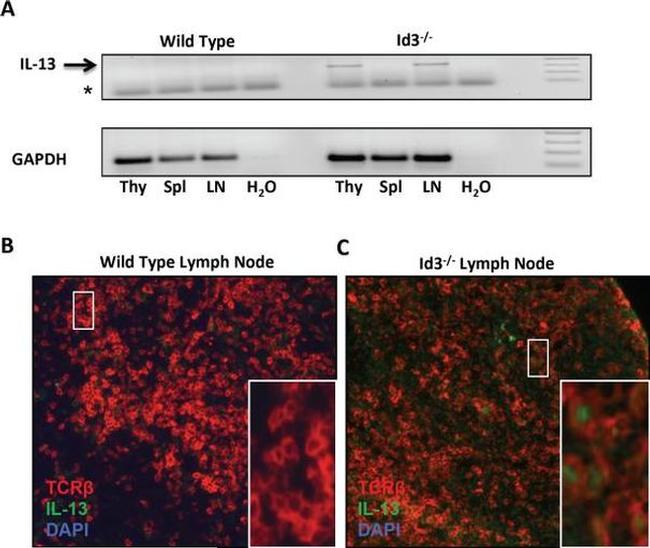 IL-13 Antibody in Immunohistochemistry (IHC)