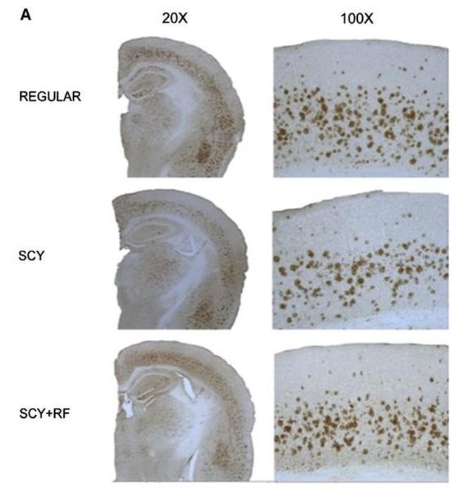 beta Amyloid (1-40) Antibody in Immunohistochemistry (IHC)