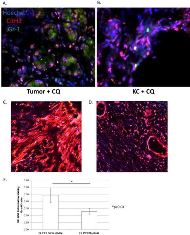 Ly-6G/Ly-6C Antibody in Immunohistochemistry (IHC)