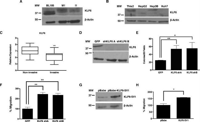 KLF6 Antibody in Western Blot (WB)