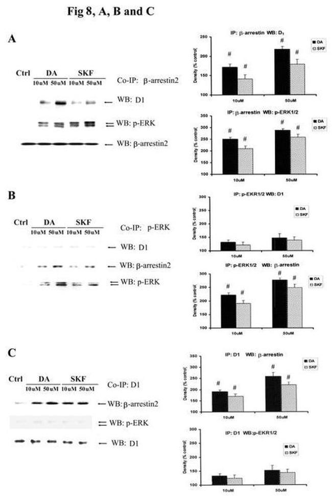 beta-Arrestin 2 Antibody in Immunoprecipitation (IP)