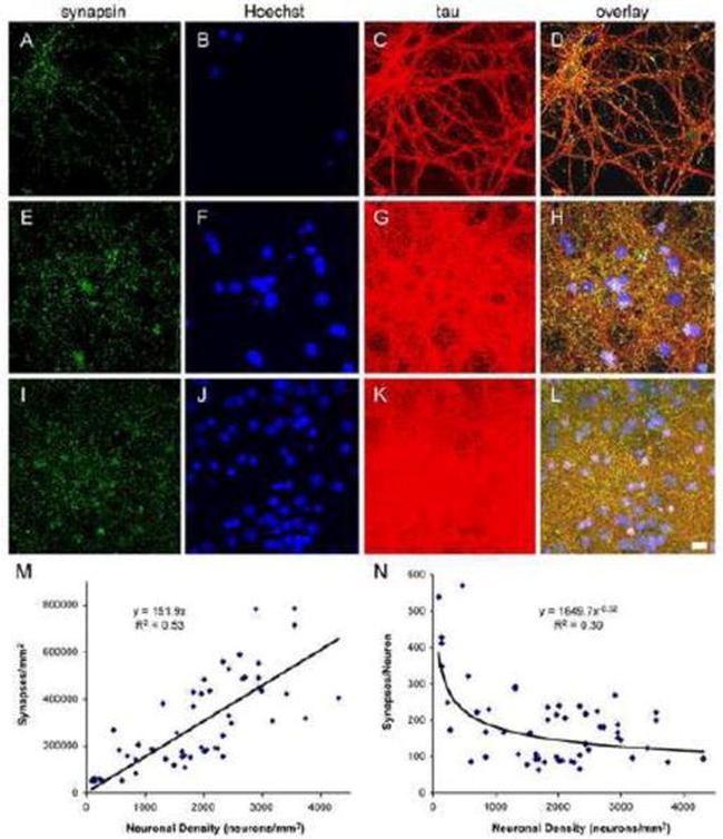 Synapsin 1 Antibody in Immunocytochemistry (ICC/IF)