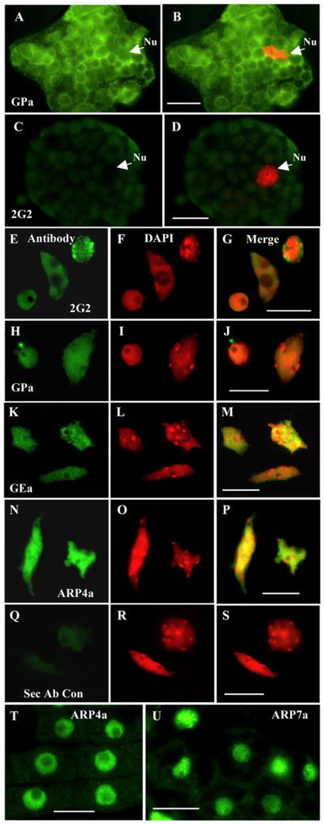 Actin Antibody in Immunocytochemistry (ICC/IF)